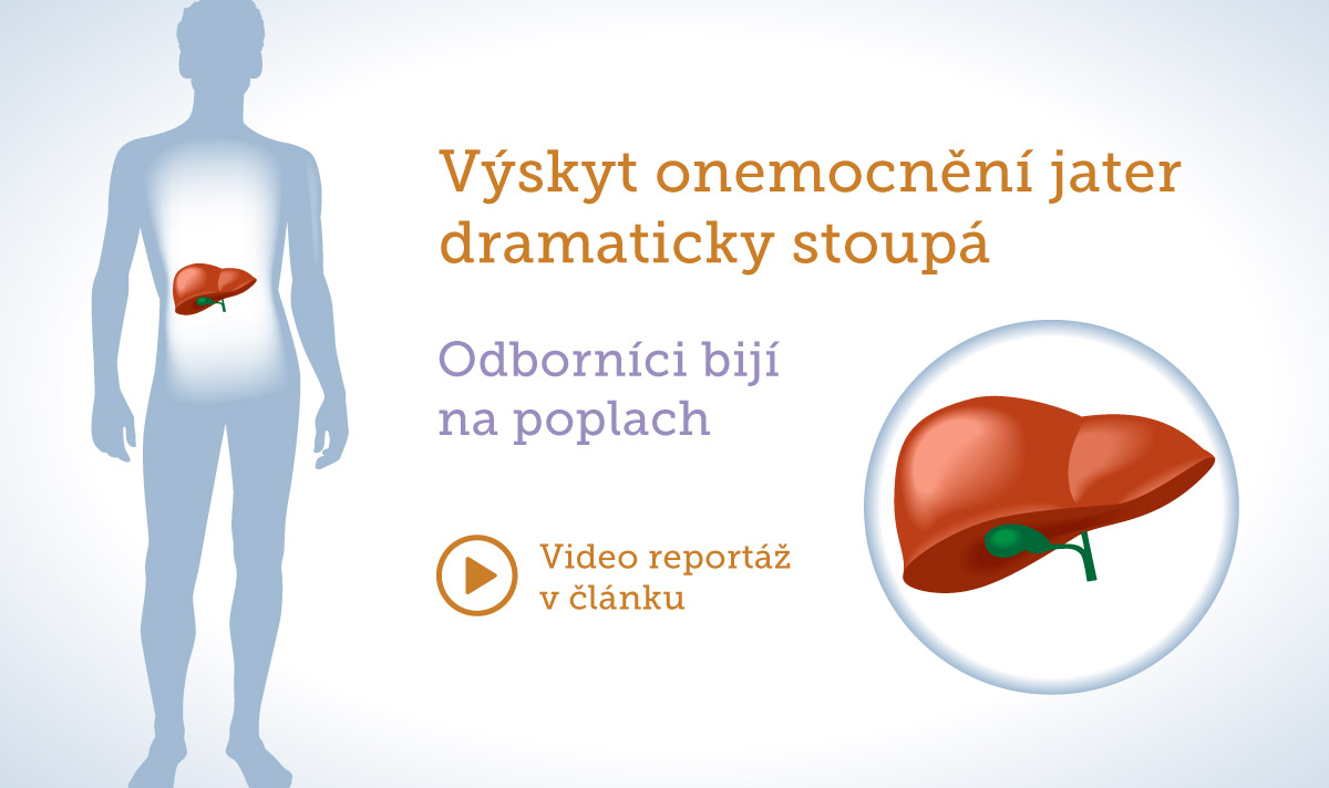 Výskyt onemocnění jater dramaticky stoupá. Ostropestřec pomůže